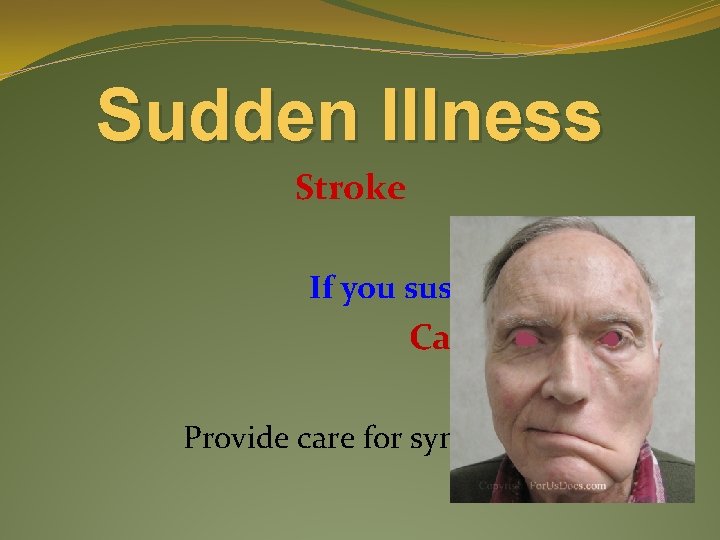 Sudden Illness Stroke Care If you suspect a stroke, Call 911 – ASAP Time