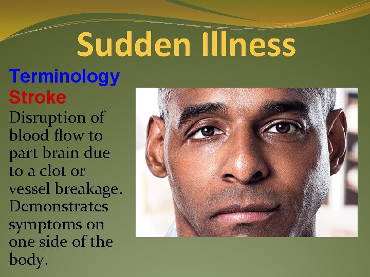 Sudden Illness Terminology Stroke Disruption of blood flow to part brain due to a