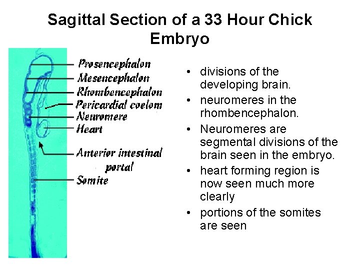 Sagittal Section of a 33 Hour Chick Embryo • divisions of the developing brain.