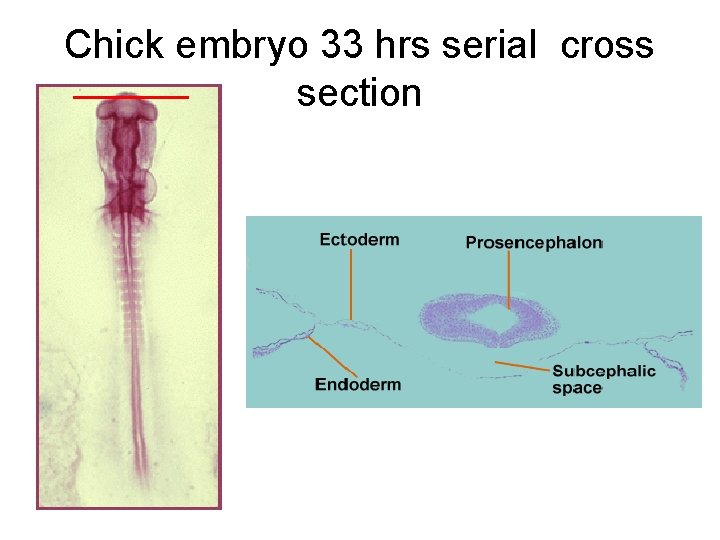 Chick embryo 33 hrs serial cross section 