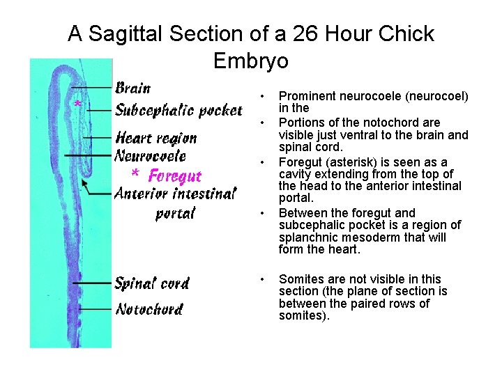 A Sagittal Section of a 26 Hour Chick Embryo • • • Prominent neurocoele