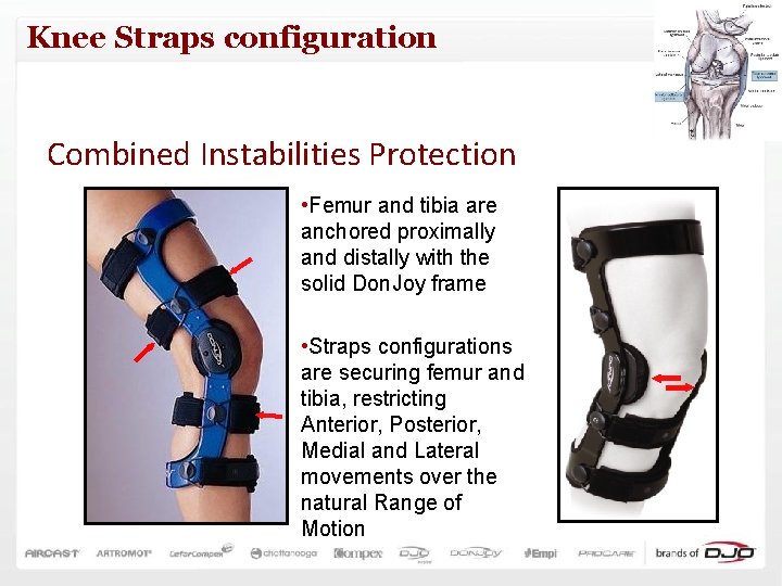 Knee Straps configuration Combined Instabilities Protection • Femur and tibia are anchored proximally and