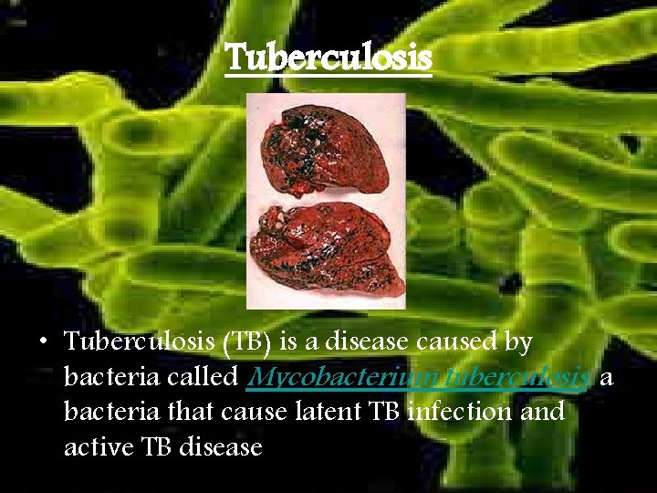 Tuberculosis • Tuberculosis (TB) is a disease caused by bacteria called Mycobacterium tuberculosis, a