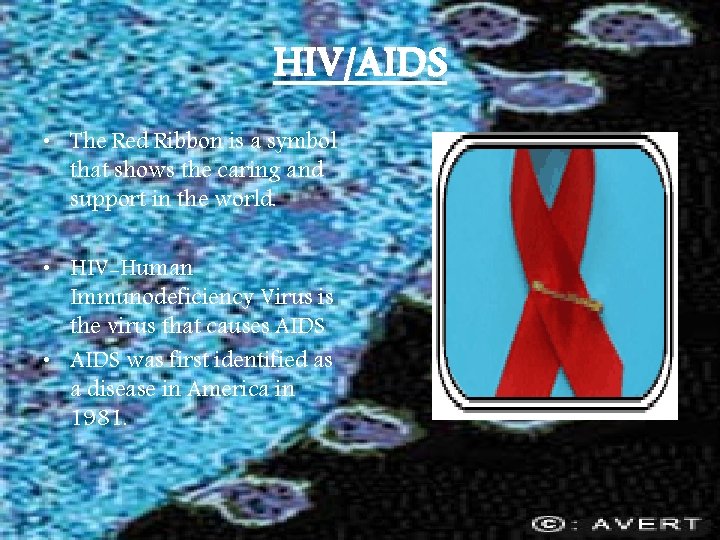 HIV/AIDS • The Red Ribbon is a symbol that shows the caring and support