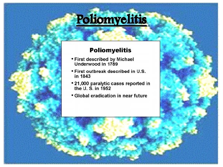 Poliomyelitis 