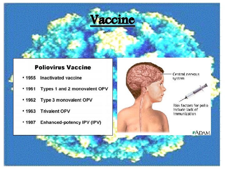 Vaccine 