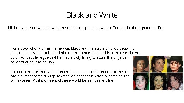 Black and White Michael Jackson was known to be a special specimen who suffered