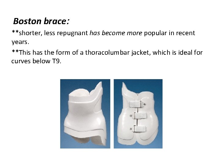 Boston brace: **shorter, less repugnant has become more popular in recent years. **This has