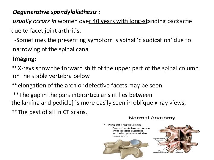 Degenerative spondylolisthesis : usually occurs in women over 40 years with long-standing backache due