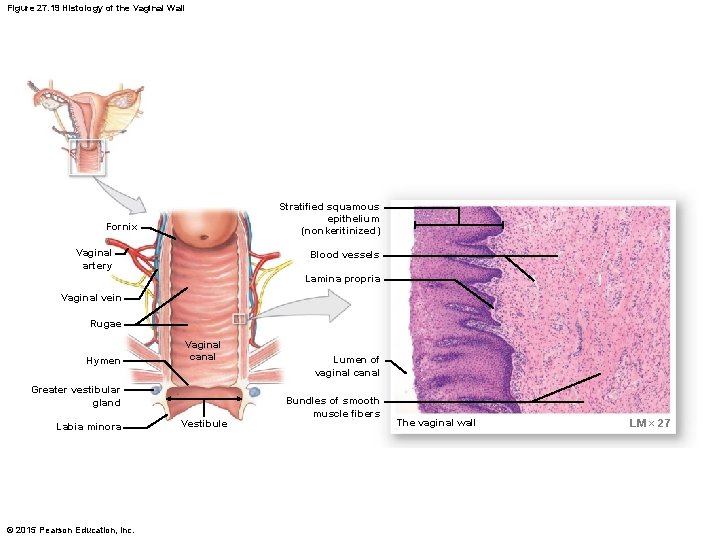 Figure 27. 19 Histology of the Vaginal Wall Stratified squamous epithelium (nonkeritinized) Fornix Vaginal