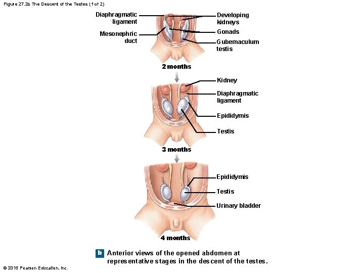 Figure 27. 2 b The Descent of the Testes (1 of 2) Diaphragmatic ligament