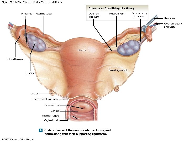 Figure 27. 11 a The Ovaries, Uterine Tubes, and Uterus Structures Stabilizing the Ovary