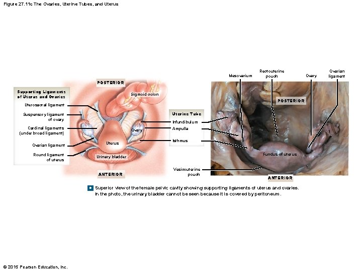 Figure 27. 11 c The Ovaries, Uterine Tubes, and Uterus Mesovarium Rectouterine pouch POSTERIOR
