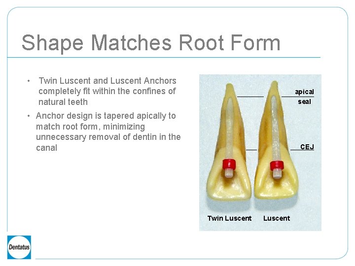 Shape Matches Root Form • Twin Luscent and Luscent Anchors completely fit within the