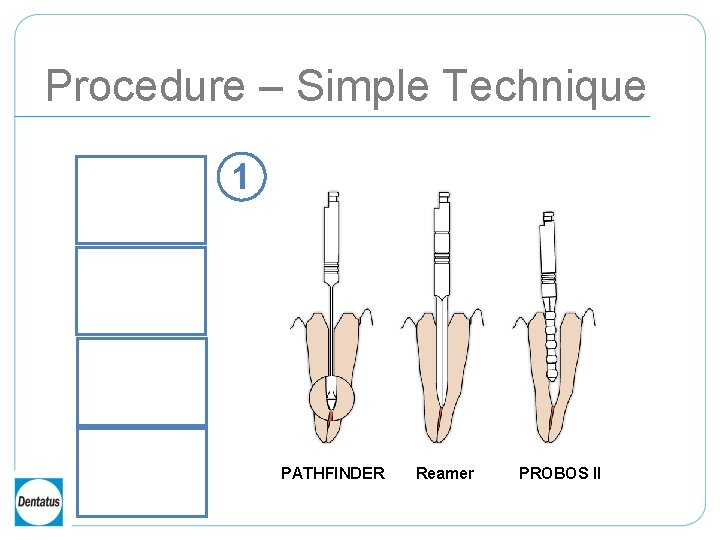 Procedure – Simple Technique 1 PATHFINDER Reamer PROBOS II 