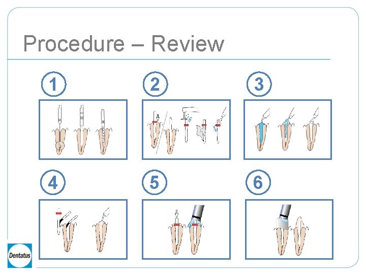 Procedure – Review 1 2 3 4 5 6 