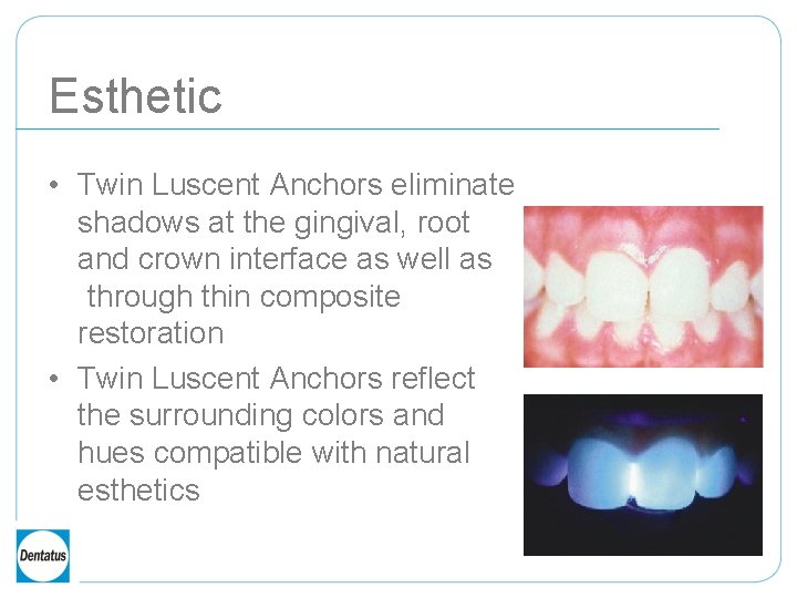 Esthetic • Twin Luscent Anchors eliminate shadows at the gingival, root and crown interface