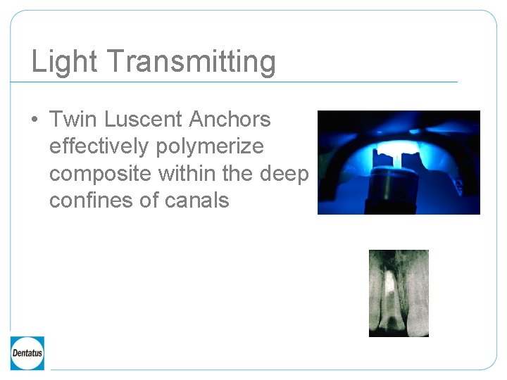 Light Transmitting • Twin Luscent Anchors effectively polymerize composite within the deep confines of
