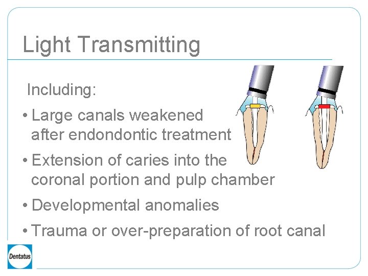 Light Transmitting Including: • Large canals weakened after endondontic treatment • Extension of caries