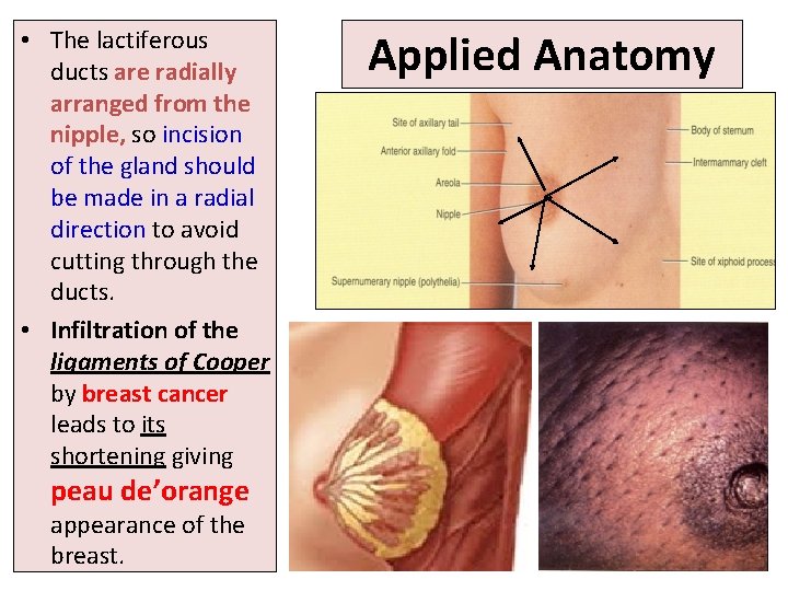  • The lactiferous ducts are radially arranged from the nipple, so incision of