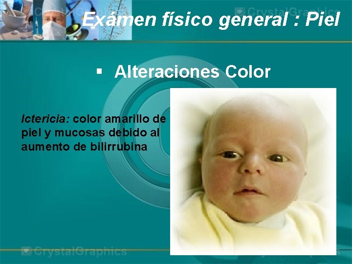 Exámen físico general : Piel § Alteraciones Color Ictericia: color amarillo de piel y