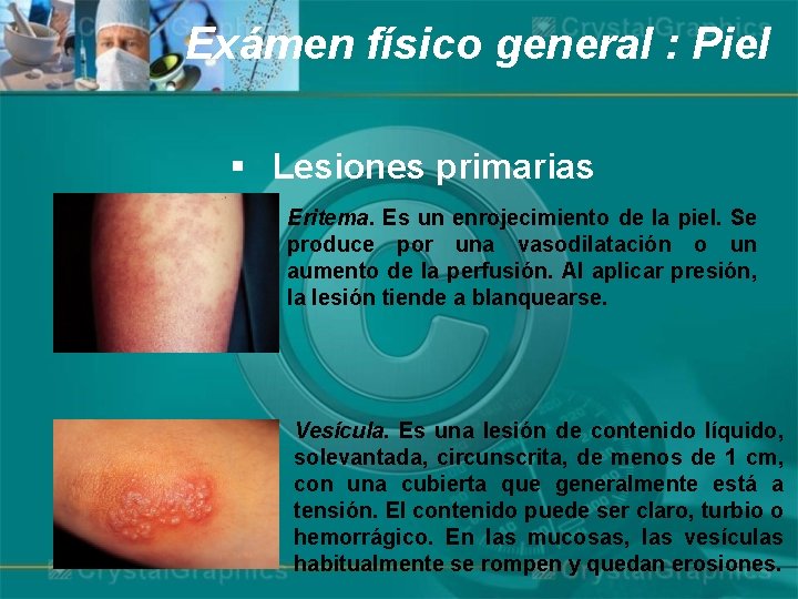 Exámen físico general : Piel § Lesiones primarias Eritema. Es un enrojecimiento de la