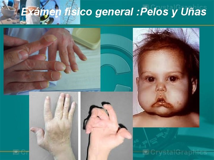 Exámen físico general : Pelos y Uñas 