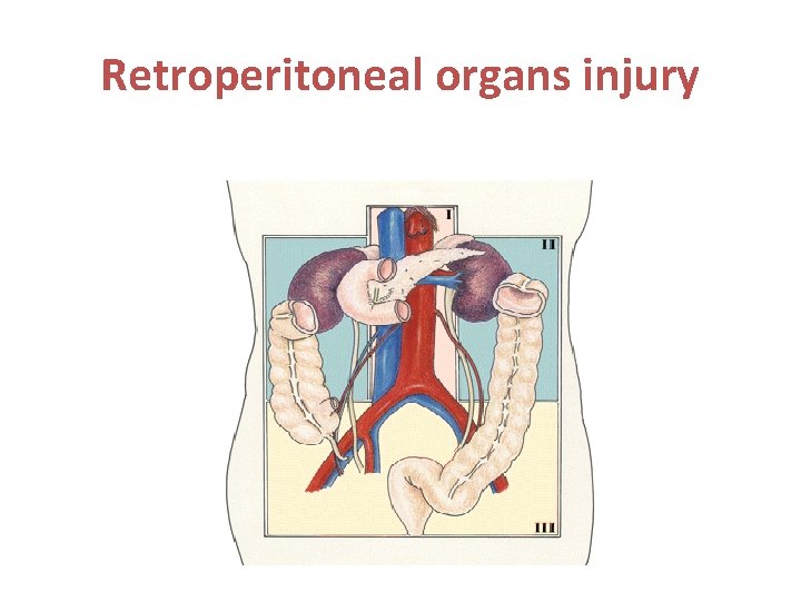Retroperitoneal organs injury 