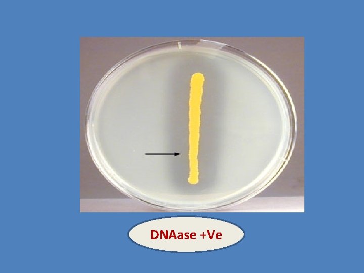 DNAase +Ve 