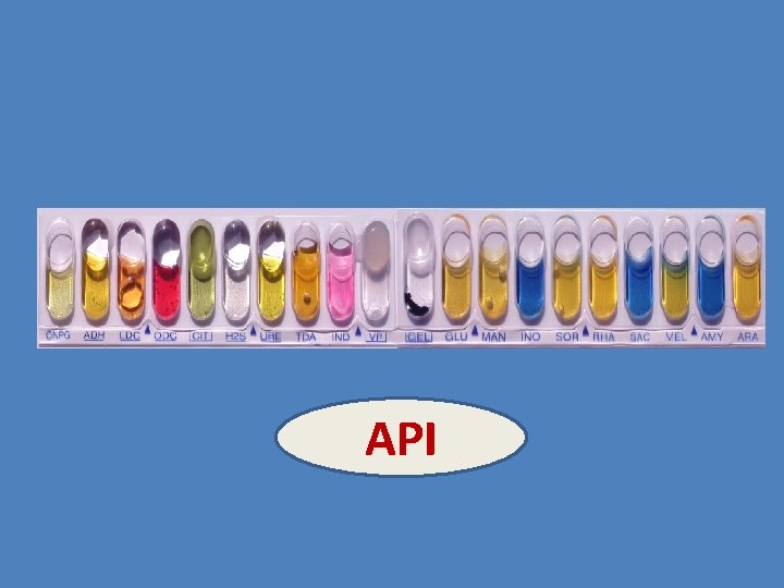 API 
