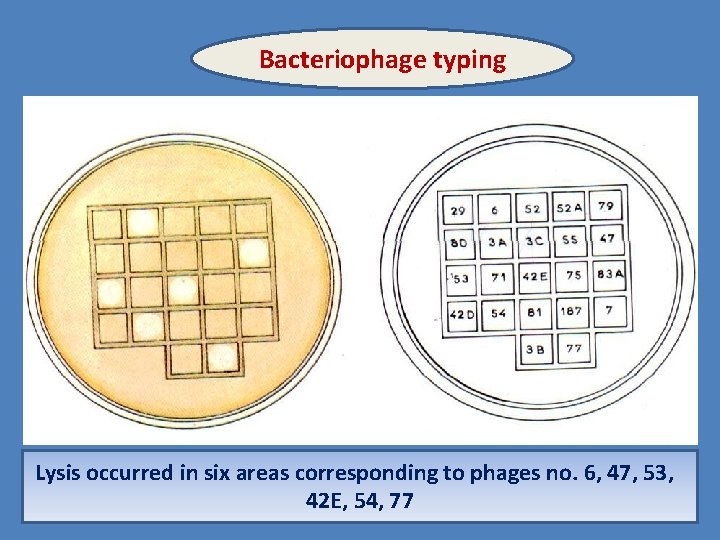 Bacteriophage typing Lysis occurred in six areas corresponding to phages no. 6, 47, 53,