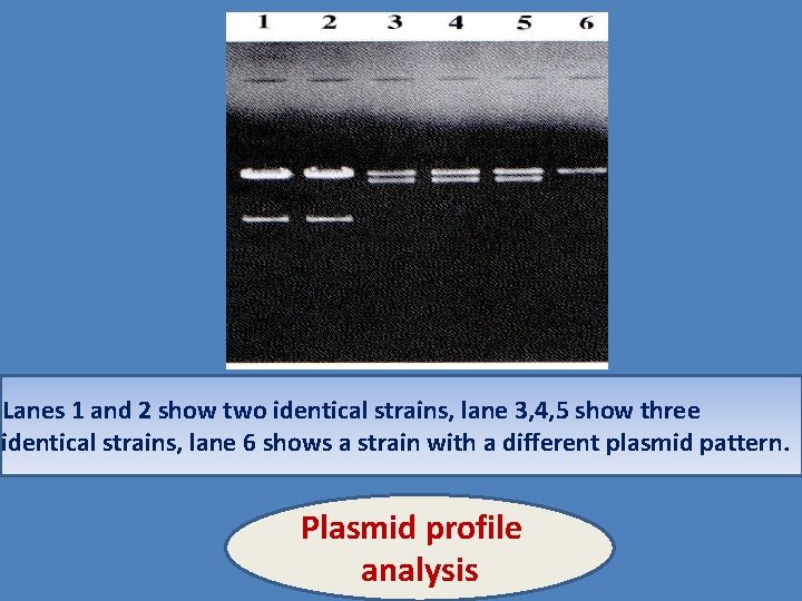 Lanes 1 and 2 show two identical strains, lane 3, 4, 5 show three