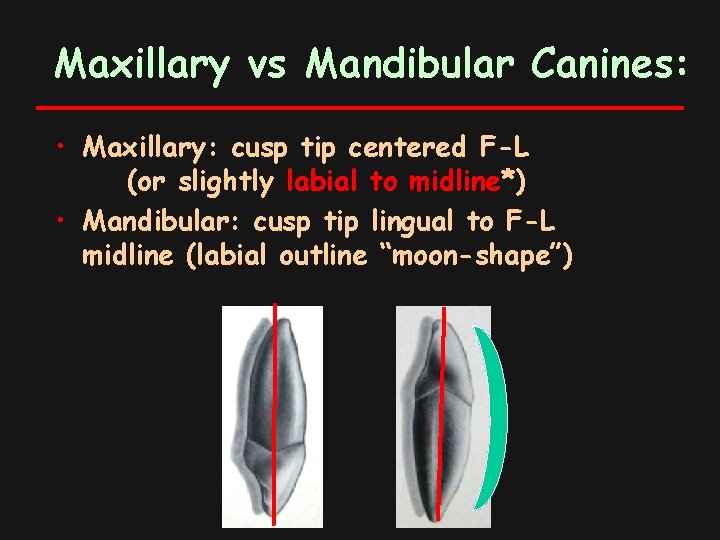 Maxillary vs Mandibular Canines: • Maxillary: cusp tip centered F-L (or slightly labial to