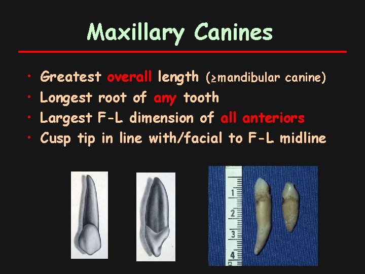 Maxillary Canines • • Greatest overall length (≥mandibular canine) Longest root of any tooth