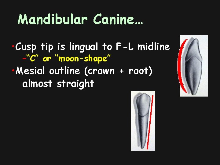 Mandibular Canine… • Cusp tip is lingual to F-L midline –“C” or “moon-shape” •
