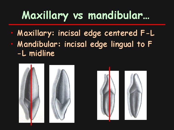 Maxillary vs mandibular… • Maxillary: incisal edge centered F-L • Mandibular: incisal edge lingual