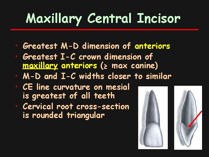 Maxillary Central Incisor • Greatest M-D dimension of anteriors • Greatest I-C crown dimension