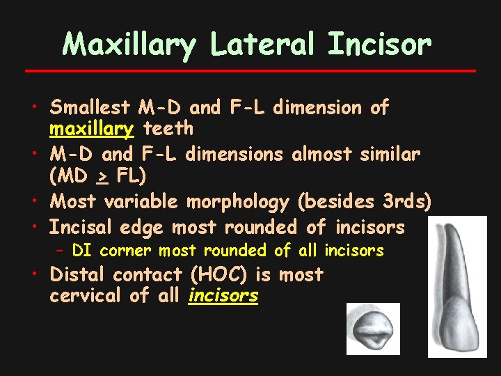 Maxillary Lateral Incisor • Smallest M-D and F-L dimension of maxillary teeth • M-D