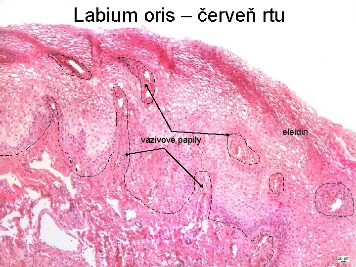 Labium oris – červeň rtu vazivové papily eleidin 