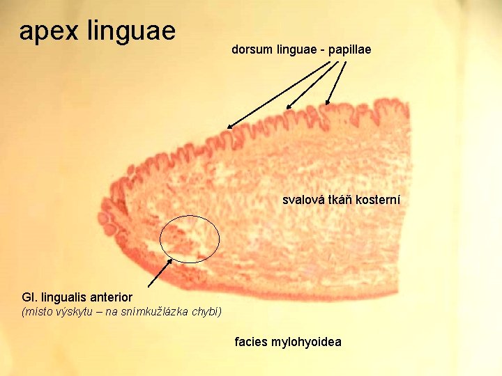 apex linguae dorsum linguae - papillae svalová tkáň kosterní Gl. lingualis anterior (místo výskytu