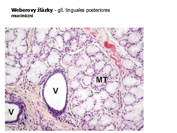 Weberovy žlázky - gll. linguales posteriores mucinózní Weberova mucinózní žláza MT-mucinózní tubuly, V-vývod. H.