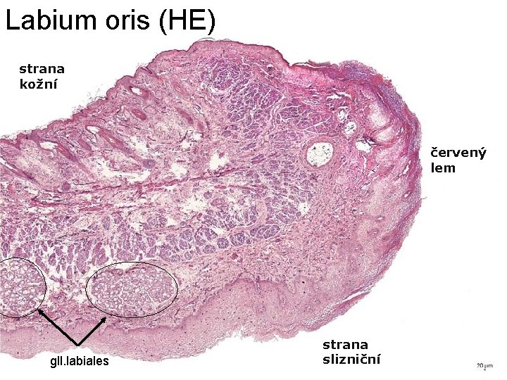 Labium oris (HE) strana kožní červený lem gll. labiales strana slizniční 