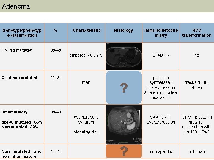 Adenoma Genotype/phenotyp e classification HNF 1α mutated β catenin mutated Inflammatory % Characteristic Histology