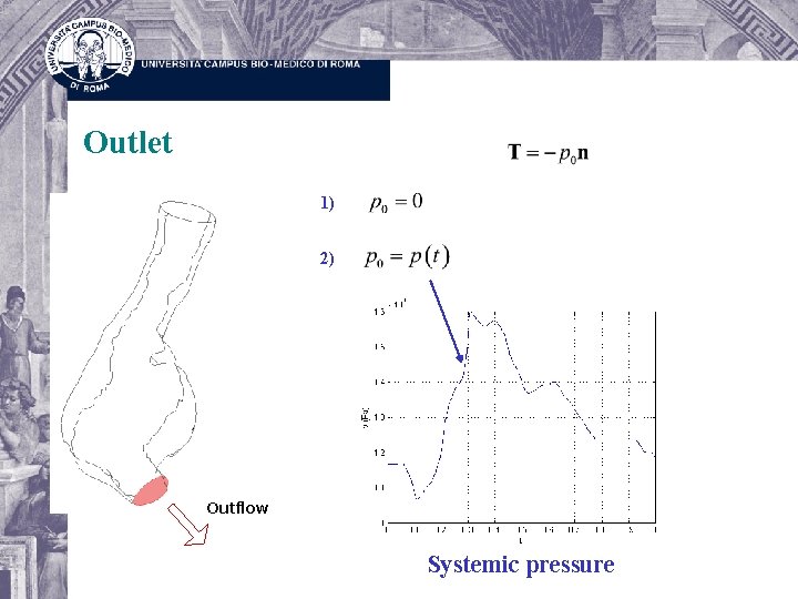 Outlet 1) 2) Outflow Systemic pressure 