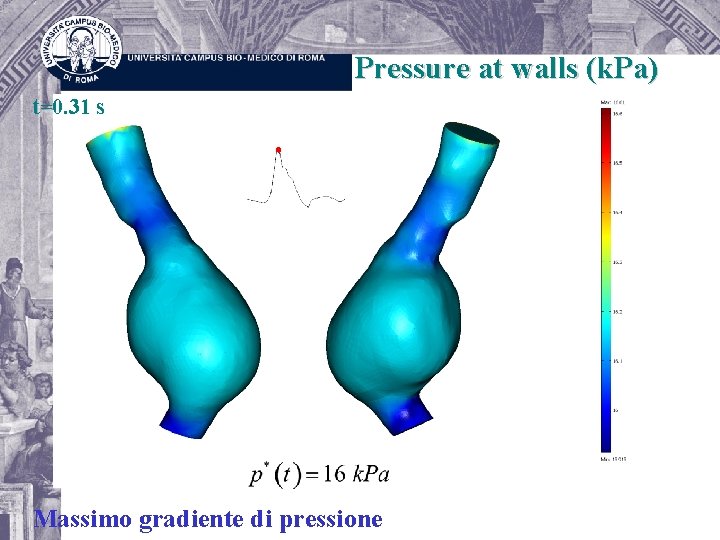 Pressure at walls (k. Pa) t=0. 31 s Massimo gradiente di pressione 