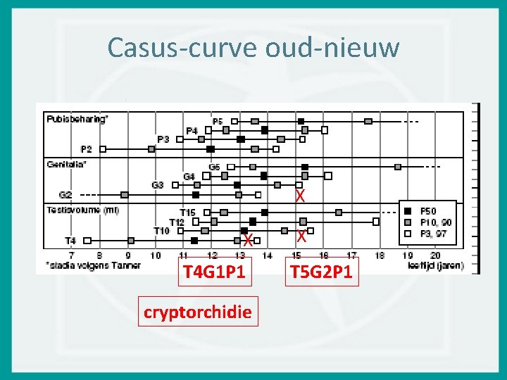 Casus-curve oud-nieuw X X T 4 G 1 P 1 cryptorchidie X T 5