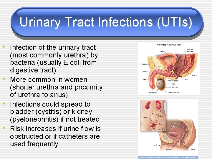 Urinary Tract Infections (UTIs) • Infection of the urinary tract • • • (most
