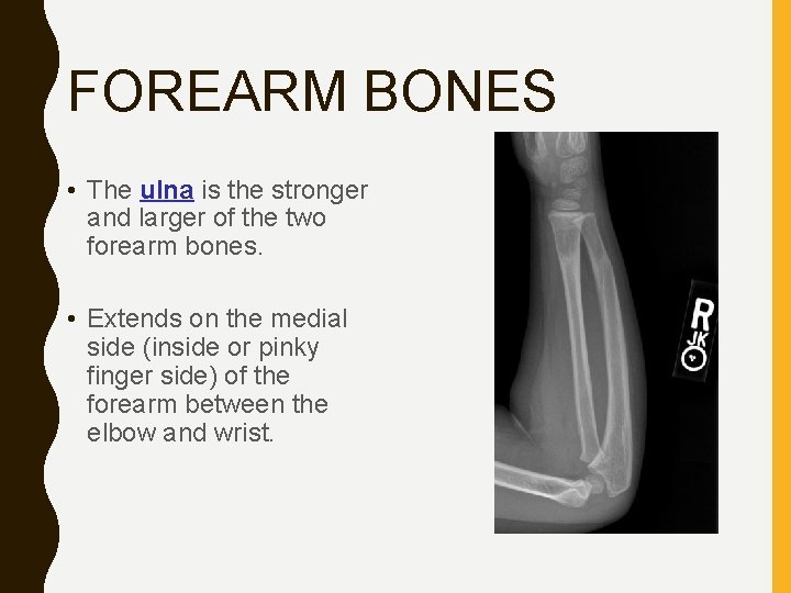 FOREARM BONES • The ulna is the stronger and larger of the two forearm