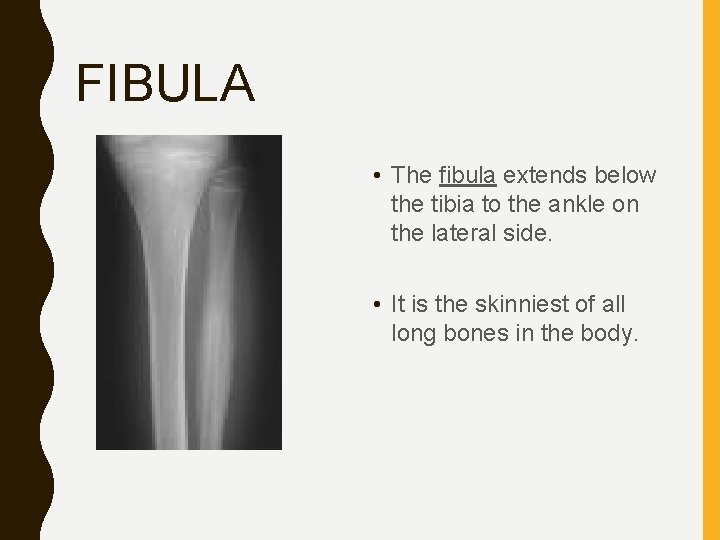 FIBULA • The fibula extends below the tibia to the ankle on the lateral