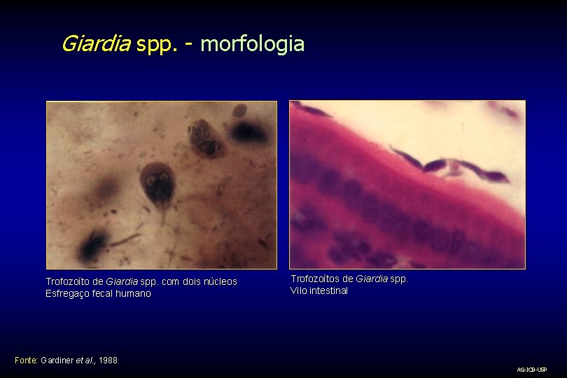 Giardia spp. - morfologia Trofozoíto de Giardia spp. com dois núcleos Esfregaço fecal humano